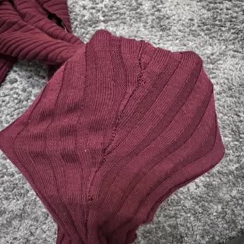 Yırtık Elbise Ve Silinen Yorumlar