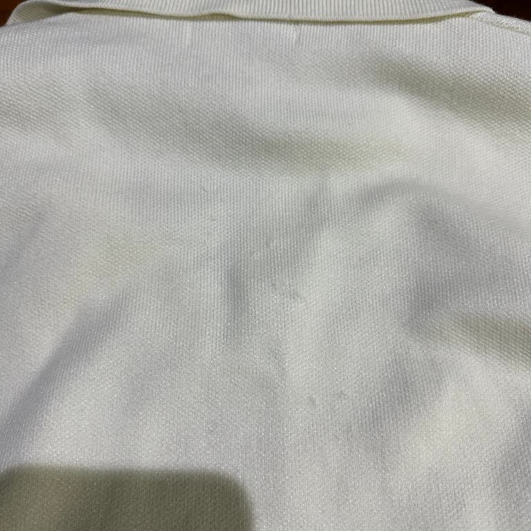 Zara Ürünlerinde Deformasyon Ve Müşteri Memnuniyetsizliği