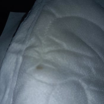 BİM Scarlett Pedinde Sağlık Tehlikesi: Üretim Koşulları Araştırılmalı