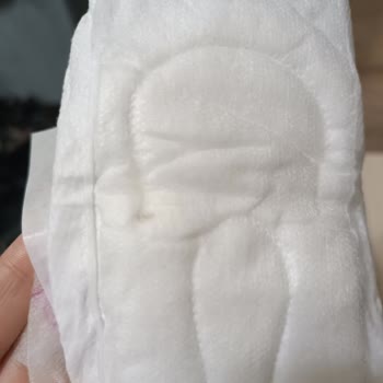 BİM Scarlett Pedinde Sağlık Tehlikesi: Üretim Koşulları Araştırılmalı