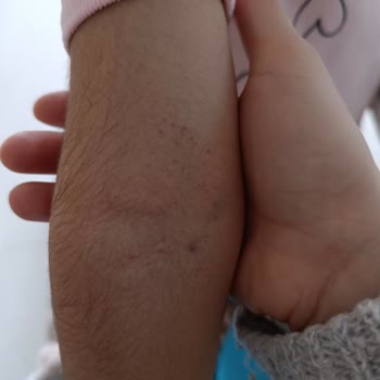 Hastanede Amatörlük Ve Yetersiz Hizmet