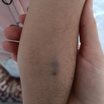 Hastanede Amatörlük Ve Yetersiz Hizmet