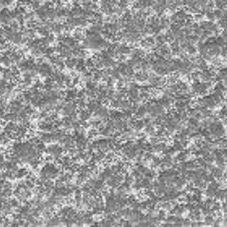 Check-Up Paketi Mağduriyeti Ve İade Talebi