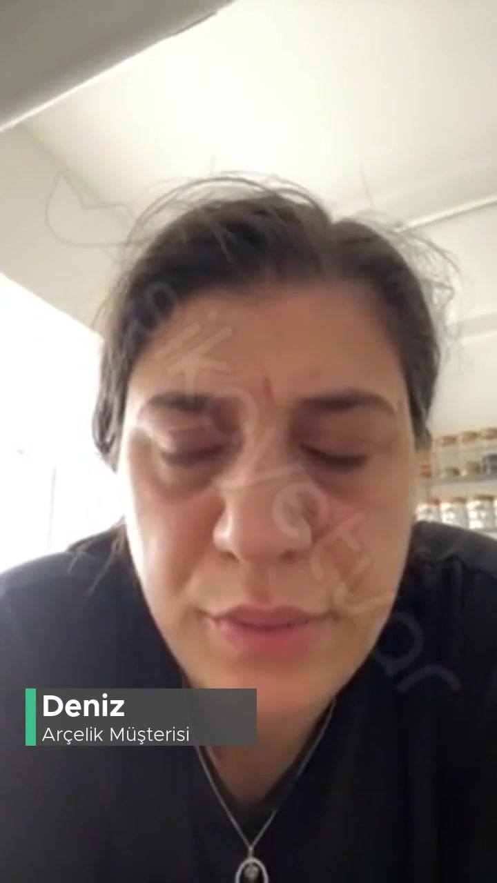 Arçelik Sorunlu Makinemin Değişimini İstiyorum videonun kapak resmi