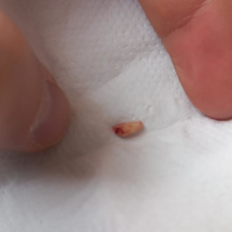 Diş Çekiminde Dikkatsizlik Ve İlgisizlik