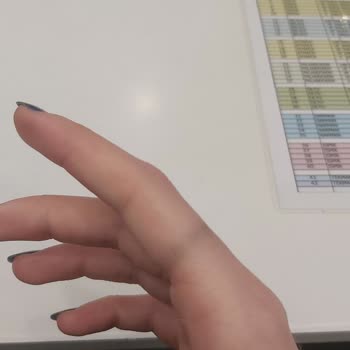 Yanlış Yüzük Seçimi Ve Çözülmeyen Mağduriyet