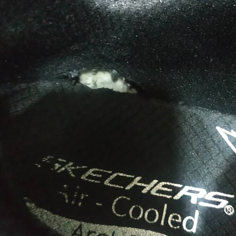 Skechers Ayakkabıda Hayal Kırıklığı: Garanti Ve Değişim Sorunu!