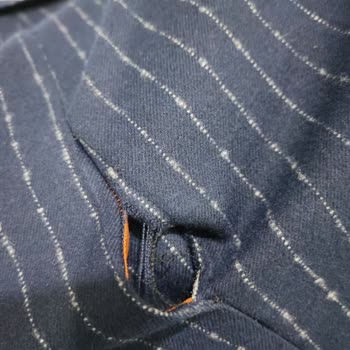 Yeni Ceketim Yırtık Çıktı, Mağaza Yardım Etmiyor!