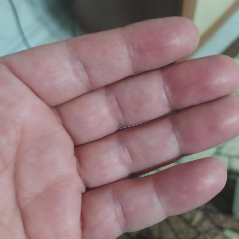 Zamanında Teslim Edilmeyen Kargo Ve Kayıp Ürün Sorunu