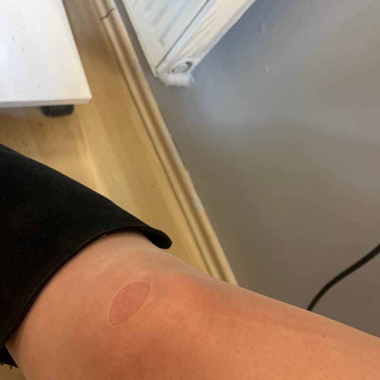 Penti Çoraplarında Sürekli Kaçma Sorunu