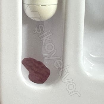 İade Sürecinde Yaşanan Sorunlar Ve Kayıp Ürün