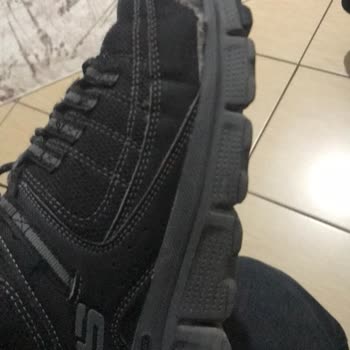Garanti Kapsamında Olmayan Skechers Ayakkabı Açılması Sorunu