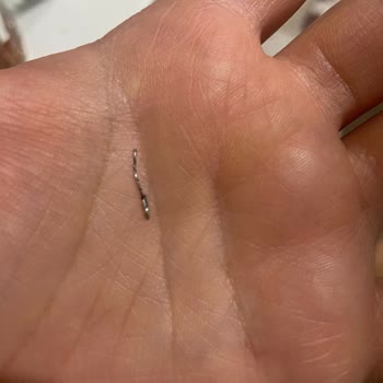 Tatlı Siparişimde Metal Parçası Şoku