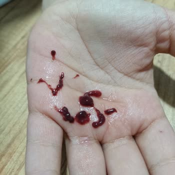 Vişneli Meyve Suyunda Şaşırtıcı Parçacıklar