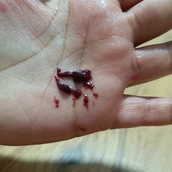 Vişneli Meyve Suyunda Şaşırtıcı Parçacıklar