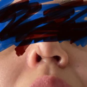 Ameliyat Sonrası Hayal Kırıklığı