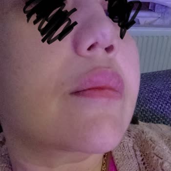 Ameliyat Sonrası Hayal Kırıklığı