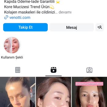 Venotti'den Aldatıcı Hizmet Ve İletişim Sorunları