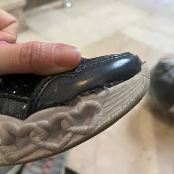 Skechers Ayakkabılarında Kalite Hayal Kırıklığı: Üç Ayda Yıpranan Ürün
