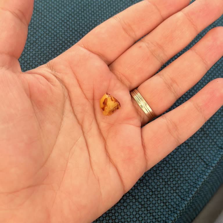 Bebek Ürünü İçinde Fındık Tehlikesi: Firma İlgisizliği Şaşırtıyor