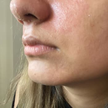 Cilt Sorunları Ve Yanıtsız İade Talebi