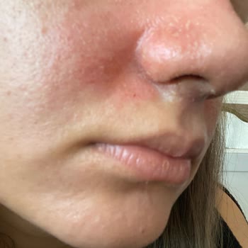 Cilt Sorunları Ve Yanıtsız İade Talebi