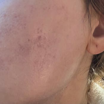 Güzelleşmek İsterken Mağdur Olduk: Klinik Skandalı