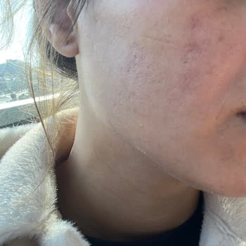 Güzelleşmek İsterken Mağdur Olduk: Klinik Skandalı