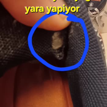 Ayakkabıda Sürekli Kusur Bulunmaması Sorunu