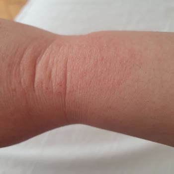 Huawei Watch GT4: Cilt Tahrişi Ve Şarj Sorunlarıyla Mücadele