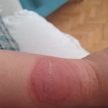 Huawei Watch GT4: Cilt Tahrişi Ve Şarj Sorunlarıyla Mücadele