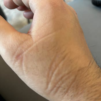 Yeni Yatakta Yay İzleri Ve Ağrılar