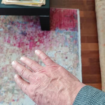 Eksik Yapılan Ameliyat Ve Sonrası Süreçte Yaşanan Sorunlar