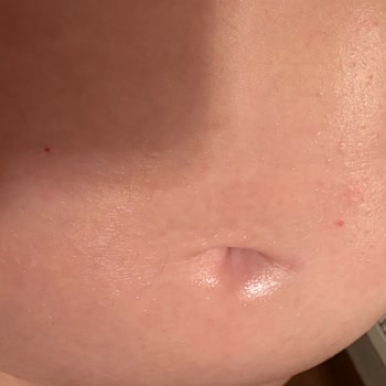 Mustela Çatlak Kremi Yan Etkileriyle Hayal Kırıklığı Yarattı