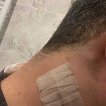 Ankara Liv Hospital'da İletişim Ve Bilgilendirme Eksikliği