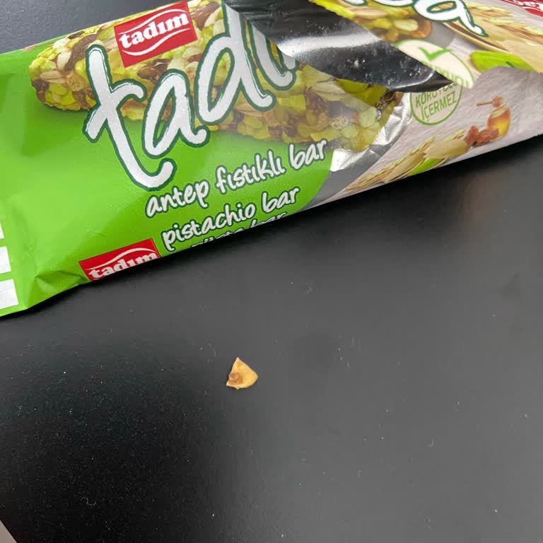 Antep Fıstıklı Bar Krizi: Diş Dolgum Zarar Gördü!