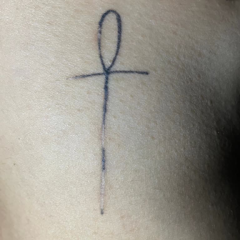 Lazer Tedavisi Ve Dövme Yanığı: Hayal Kırıklığı