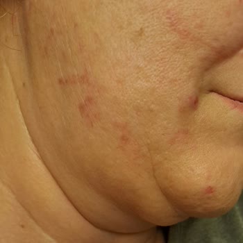 Yanıltıcı Hizmet Ve Sağlık Sorunlarıyla Karşılaştım