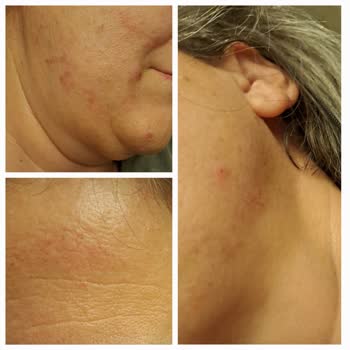 Yanıltıcı Hizmet Ve Sağlık Sorunlarıyla Karşılaştım