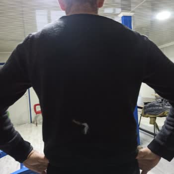 Kaz Tüyü Mont Sorunu: Garanti Ve Değişim Hayal Kırıklığı