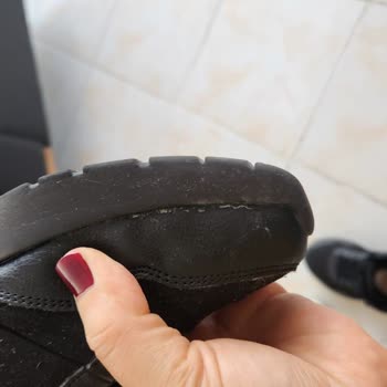 Hepsiburada Ve Skechers: Ayıplı Ürün Ve Çözüm Eksikliği