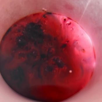 Vişne Suyunda Hareketli Parazitler Şoku