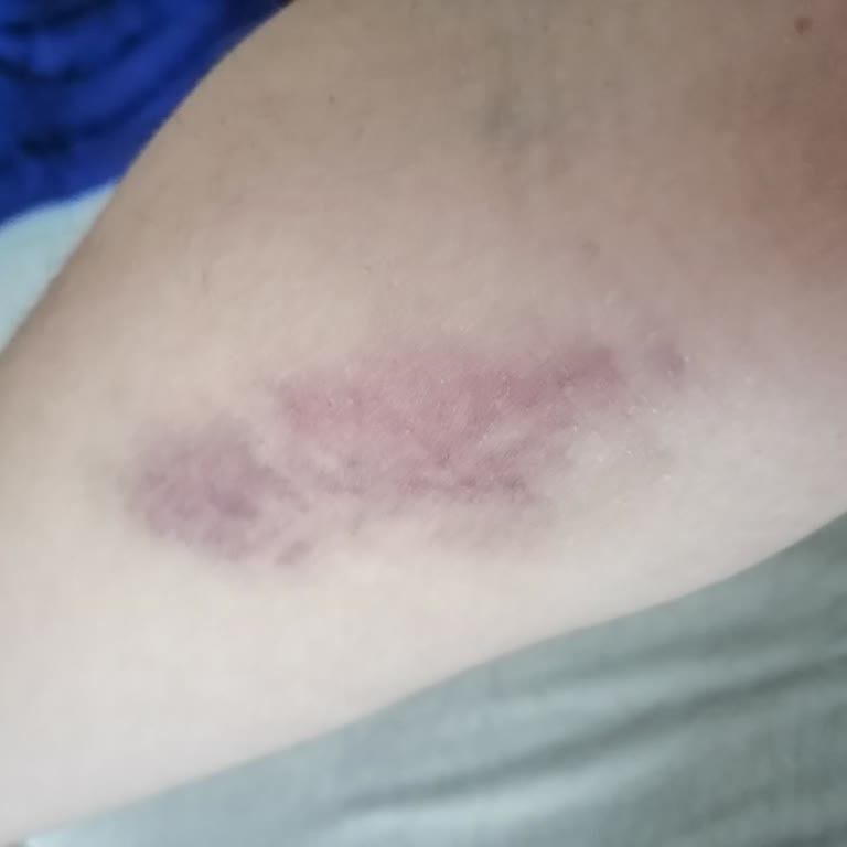 Özel Hastanede Paramızla Mağduriyet