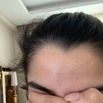 Cilt Ürünleri Kabusu: Sivilce Sorunu