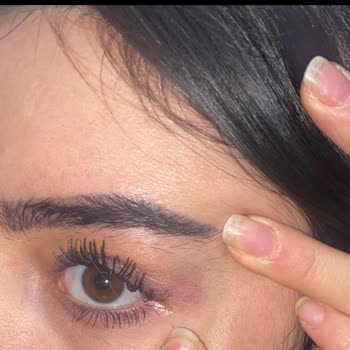 Serap Çınar Ağrılı Tedavi Ve Yüksek Ücretler!