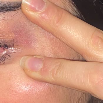 Serap Çınar Ağrılı Tedavi Ve Yüksek Ücretler!