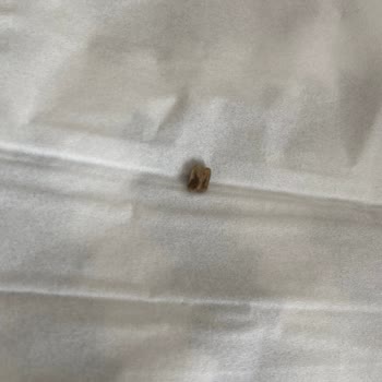 Superfresh Patates İçinden Çıkan Taş Şoku