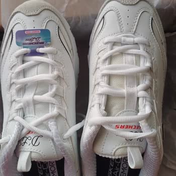 Skechers Siparişlerinde Sürekli Defolu Ürün Sorunu