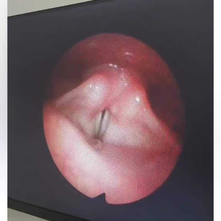 Voicest Clinic İşlem Hiçbir İşe Yaramadı