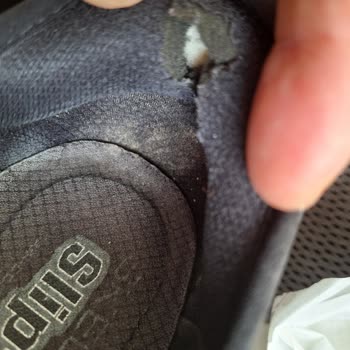 Skechers Ayakkabının Topuk Sorunu Ve Garanti Hayal Kırıklığı